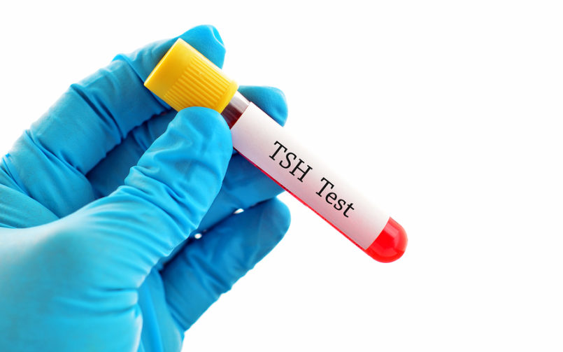 Diagnosing Hypothyroidism: The Thyroid Blood Test Roadblock